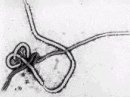 ebola virus